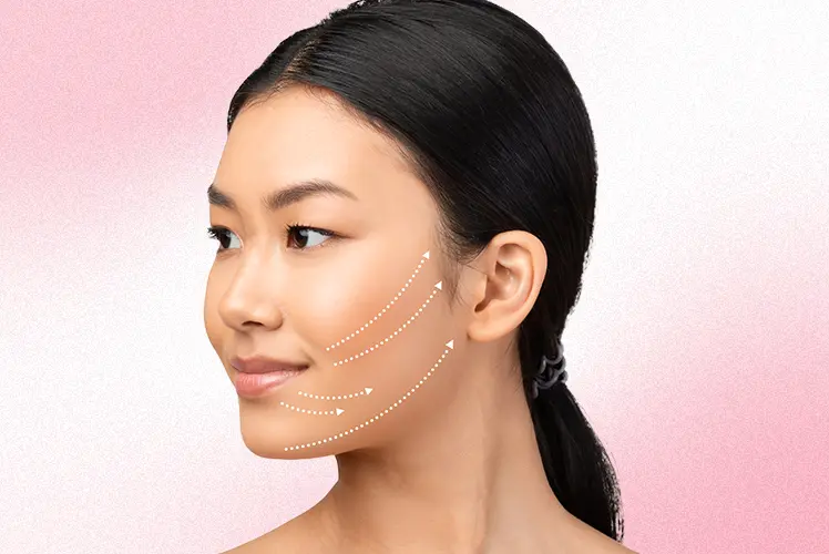 full face lift