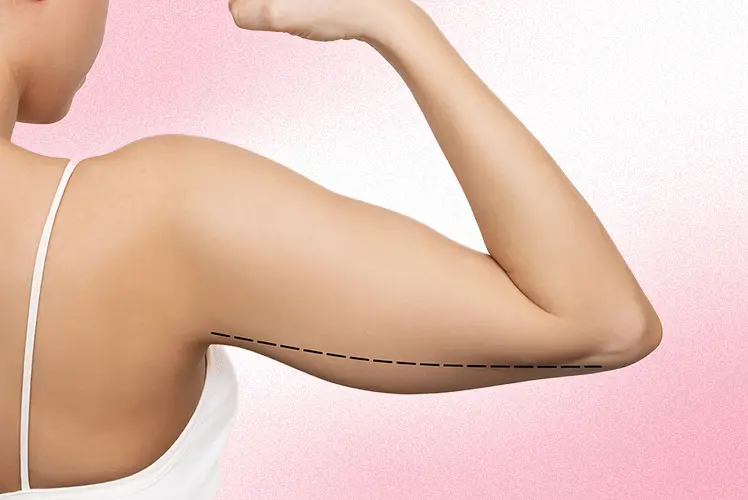 arm liposuction