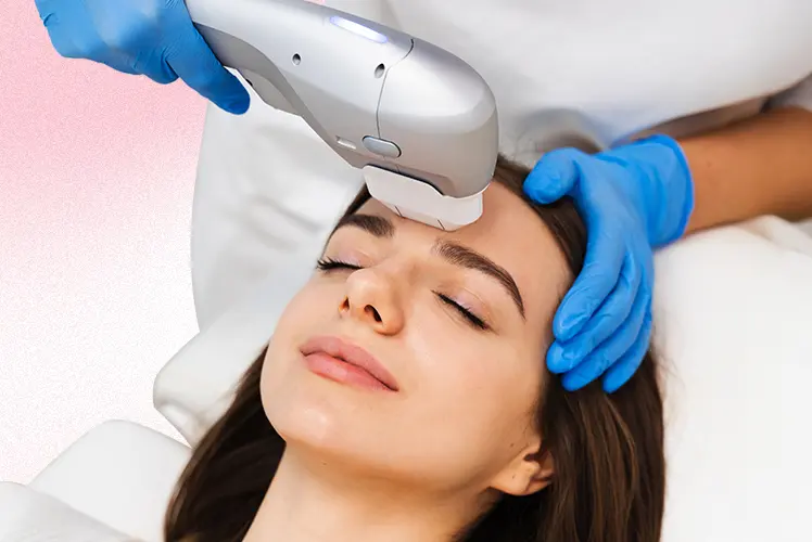 ultraformer III treatment